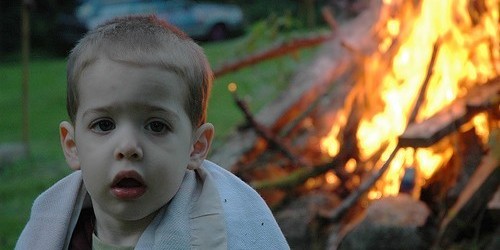 Child Safety: Burns And Scalds Care Advice