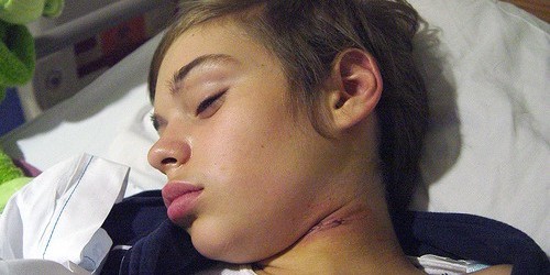 Study Discovered New Genes Causing Childhood Epilepsy