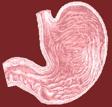 Chronic gastric ulcer