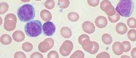 lymphocytes neutrophils neutrophil lymphocyte ratio