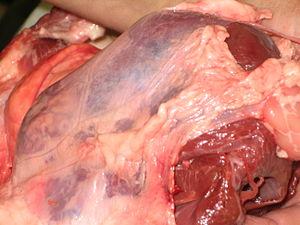 Chronic pericarditis facts