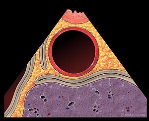 Classification of aortic aneurysm