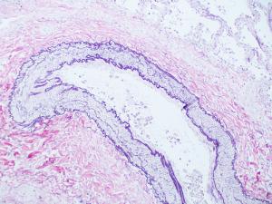 Clean arteries facts