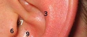 Clogged ear remedy