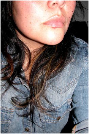 Cold sores treatment