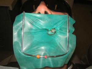 Common root canal problems