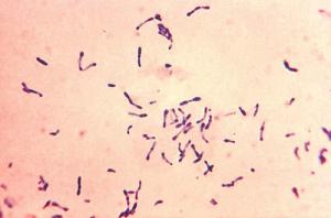 Complications of diphtheria