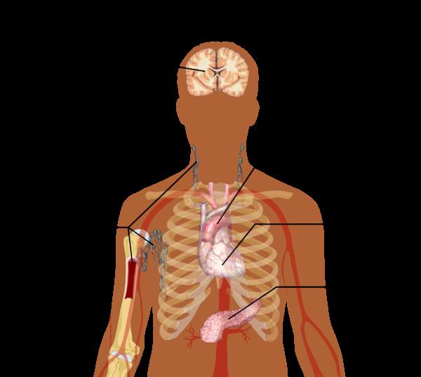Complications of forceps delivery