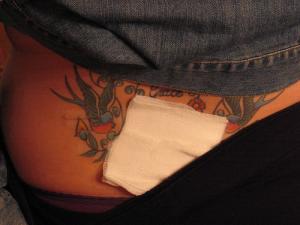 Complications of lumbar puncture