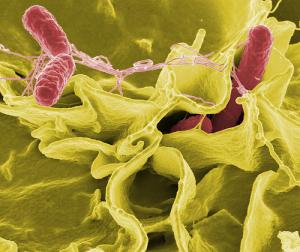 Complications of salmonella