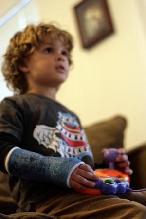 Complications of wrist fractures
