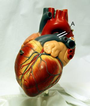 Congestive heart failure in the elderly