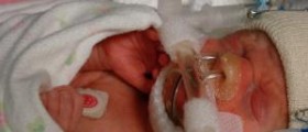 CPAP therapy review