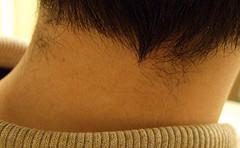 Cracking neck muscles