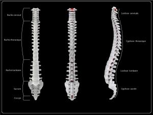 Curvature of the spine