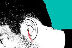 Deafness from burst eardrum