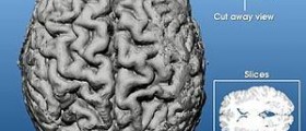 Deep brain stimulation for depression