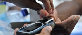 Types of Diabetic Neuropathy