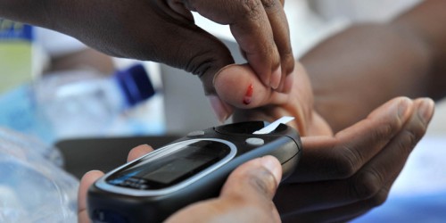 Types of Diabetic Neuropathy