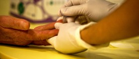 Diabetes and weight loss