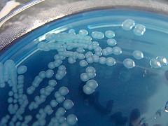 Diarrhea from bacteria