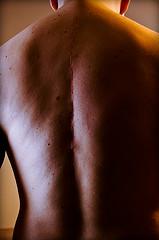 Different types of adult scoliosis