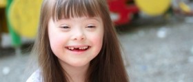 New Findings Give Hope For Down's Syndrome Patients