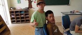 Down syndrome and seizures
