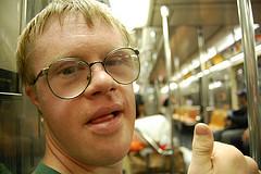 Down syndrome birth statistics