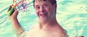 Down syndrome typical features