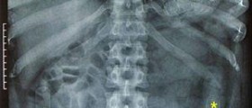 Drug abuse and lung disease