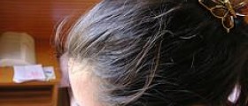 Drug allergy hair loss
