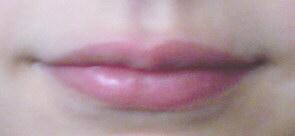 Dry skin around mouth
