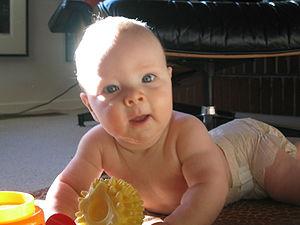 Dry skin on baby's face