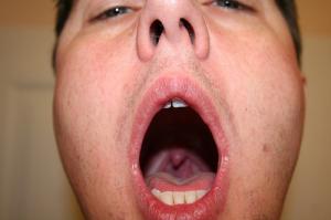 Dry throat in the morning