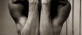 Dystonia causes and symptoms