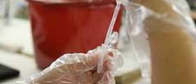 E. coli in urine