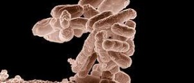 E coli in your urine