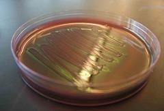 E coli symptoms