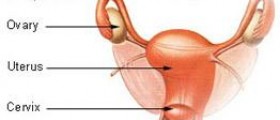 Early Symptoms of Ovarian hyperstimulation syndrome (OHSS)