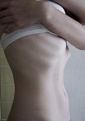 Eating disorder with peer pressure