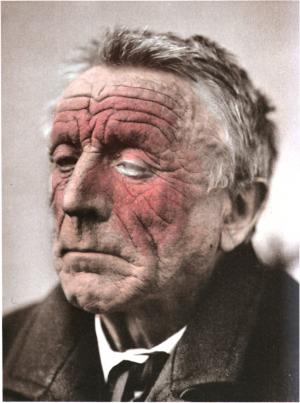 Eczema on face treatment