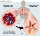 Effective management of allergic rhinitis