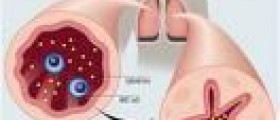 Effective management of allergic rhinitis