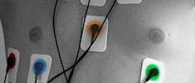Electrocardiogram in fitness: Fast heart rate