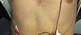 Electrocardiogram stress test