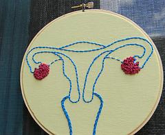 Endometrial cancer diagnosis