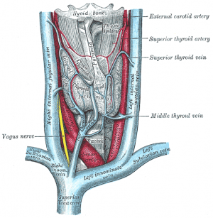 Enlarged thyroid causes