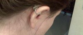 Ensuring realistic expectations from your hearing aids