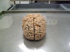 Epilepsy medication facts